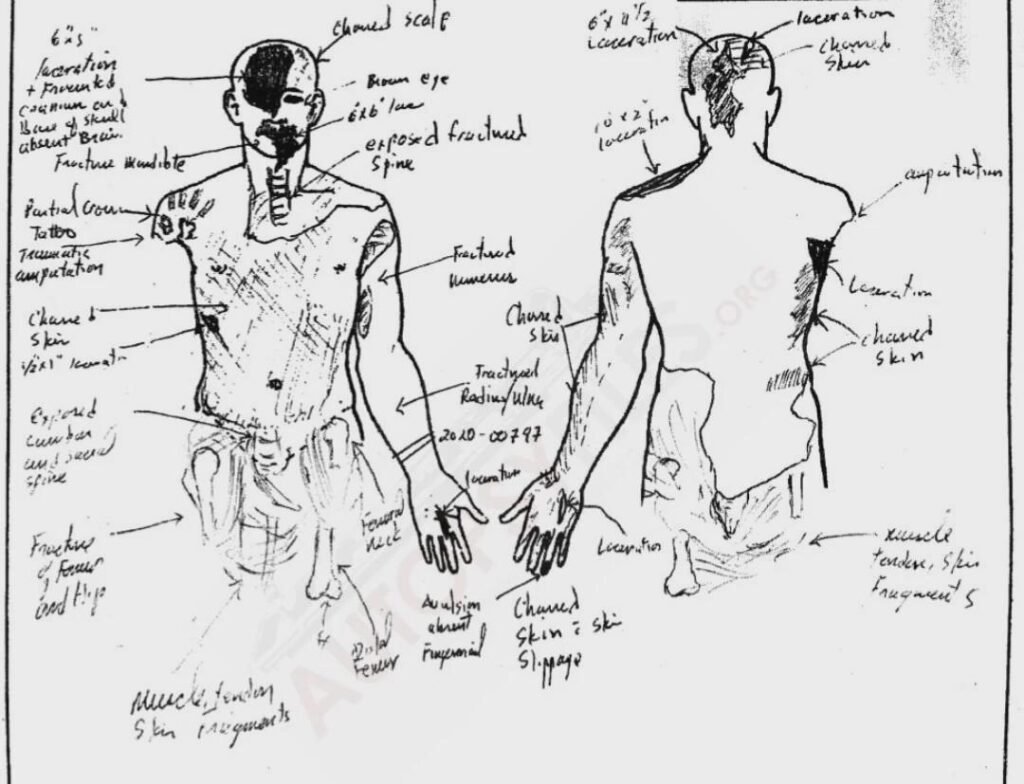 Kobe Bryant Autopsy Sketch and report