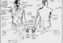 Kobe Bryant Autopsy Sketch and report