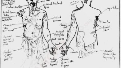 Kobe Bryant Autopsy Sketch and report
