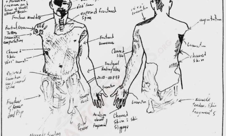 Kobe Bryant Autopsy Sketch and report