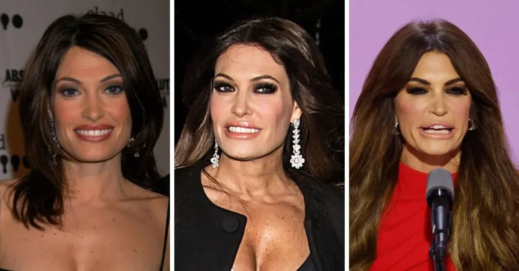 Kimberly Guilfoyle Before and After