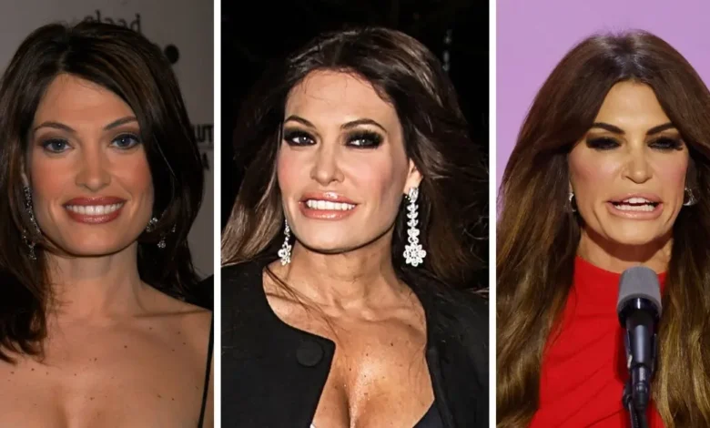 Kimberly Guilfoyle Before and After