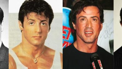 Sylvester Stallone Plastic Surgery