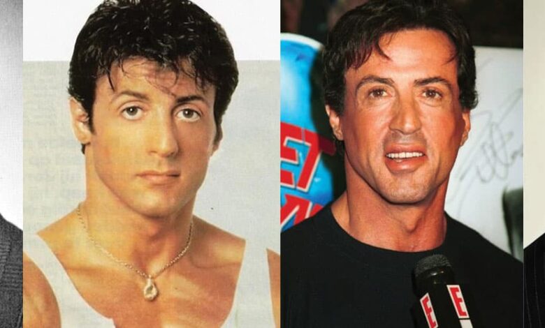 Sylvester Stallone Plastic Surgery