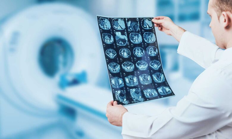 Doctorhub360.com Neurological Diseases